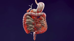 Imagem de um intestino que sofre de doenças inflamatórias intestinais