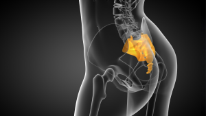 Dor e inchaço no cóccix: quando pode ser cisto pilonidal e por que investigar cedo faz diferença.